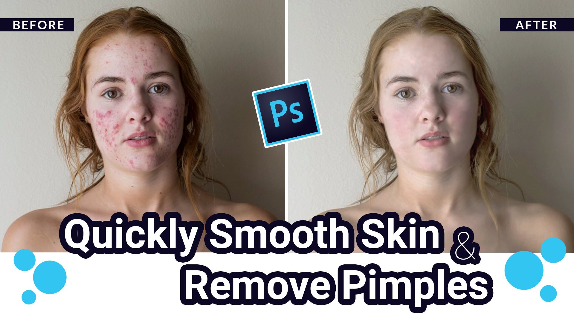 Quickly Smooth Skin and Remove Pimples